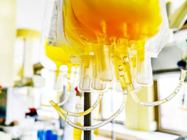 Plasma Exchange, Double-filtration plasmapheresis