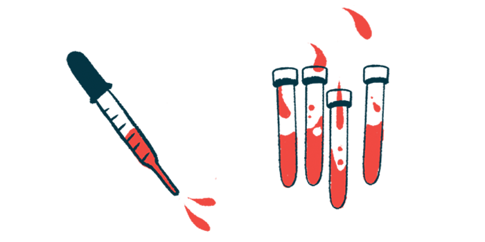 Illustration of syringe and vials with blood.