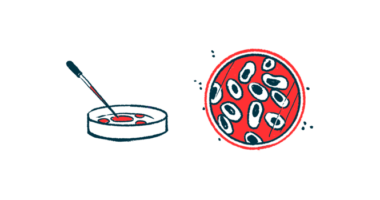 neuromuscular junction | Myasthenia Gravis News | illustration of petri dish