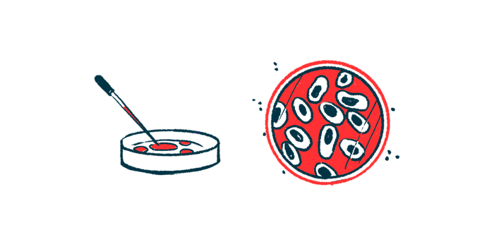 neuromuscular junction | Myasthenia Gravis News | illustration of petri dish