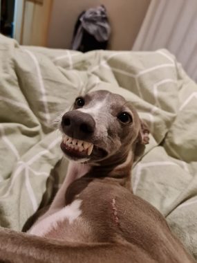Dogs, MG, and anxiety | Myasthenia Gravis News | Blitz lies on the bed and shows off his teeth in a goofy grin.