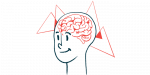 brain shrinkage in late-onset MG | Myasthenia Gravis News | brain illustration