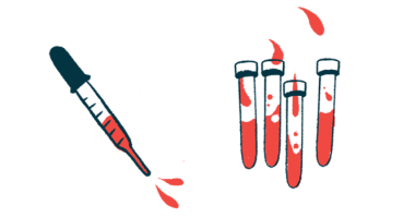 anemia among immunotherapy side effects for women | Myasthenia Gravis News | illustration of vials and dropper of blood