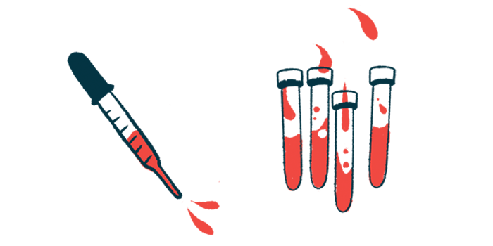 A dropper of blood is shown with four vials of blood.