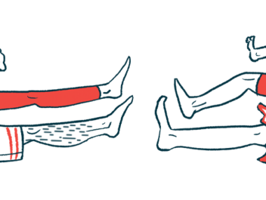 ocular myasthenia gravis | Myasthenia Gravis News | illustration of legs