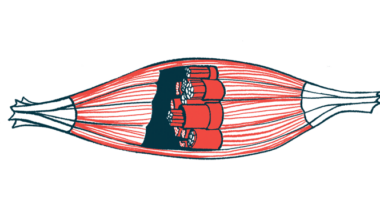 A cross-section illustration of a muscle.