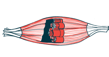 A cross-section illustration of a muscle.