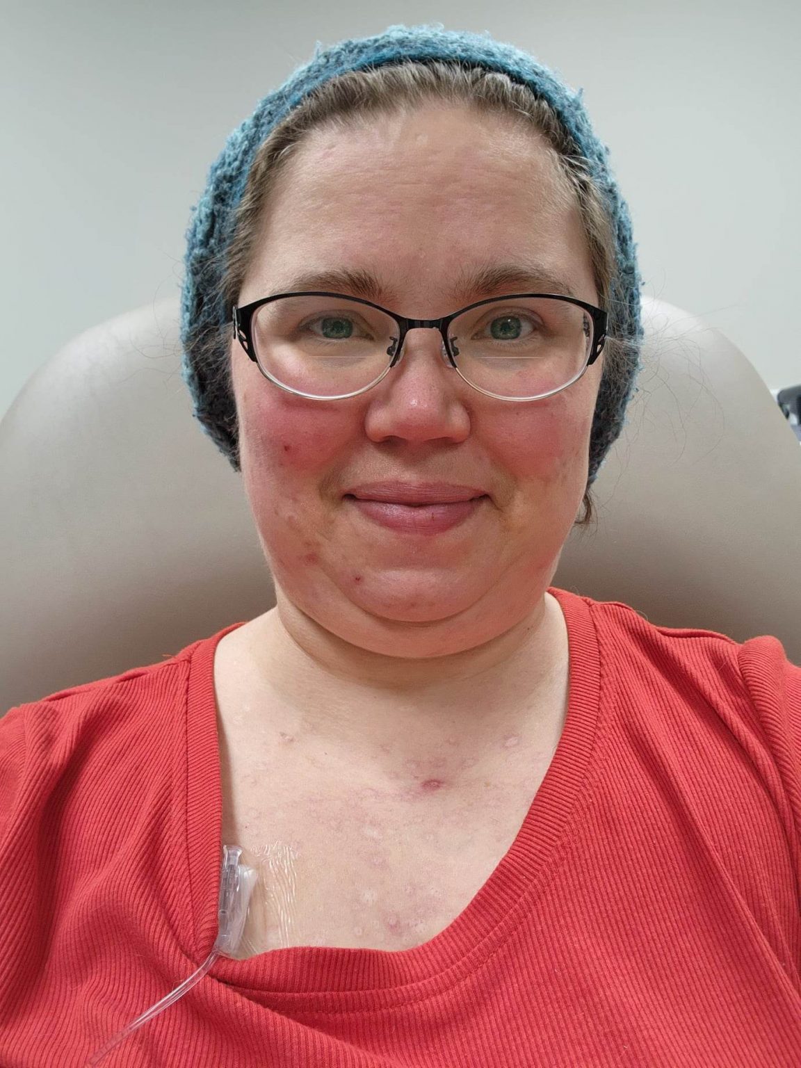 Managing Prednisoneinduced Weight Gain The Relationships Among