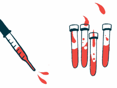 A dropper hovers next to four vials of blood.