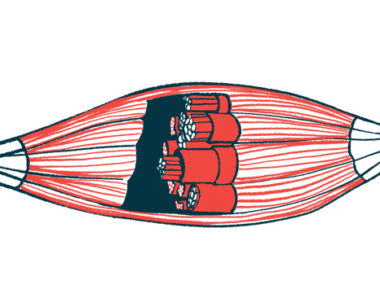 Illustration of a muscle.