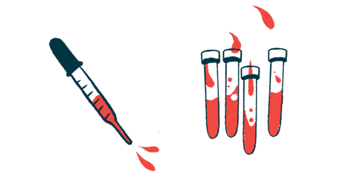 A dropper is shown hovering next to vials of blood.