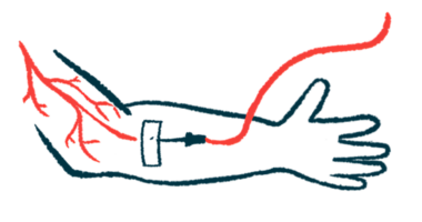 An intravenous infusion line is inserted in an arm.