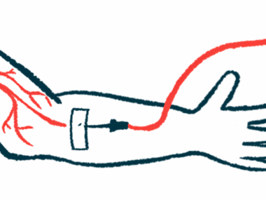 An intravenous infusion line is inserted in an arm.