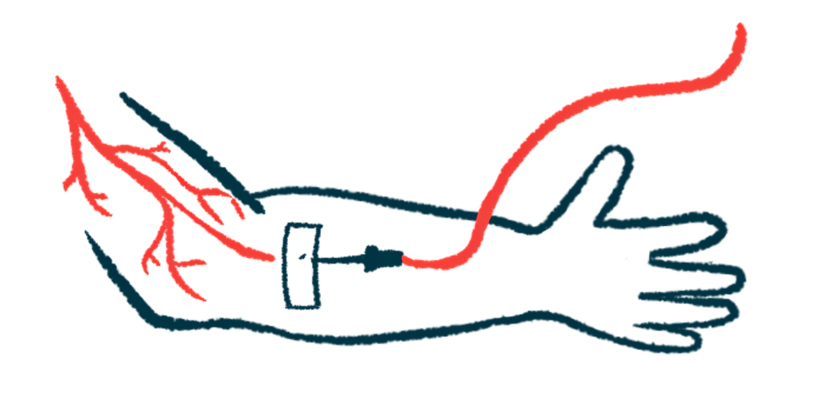 An intravenous infusion line is inserted in an arm.