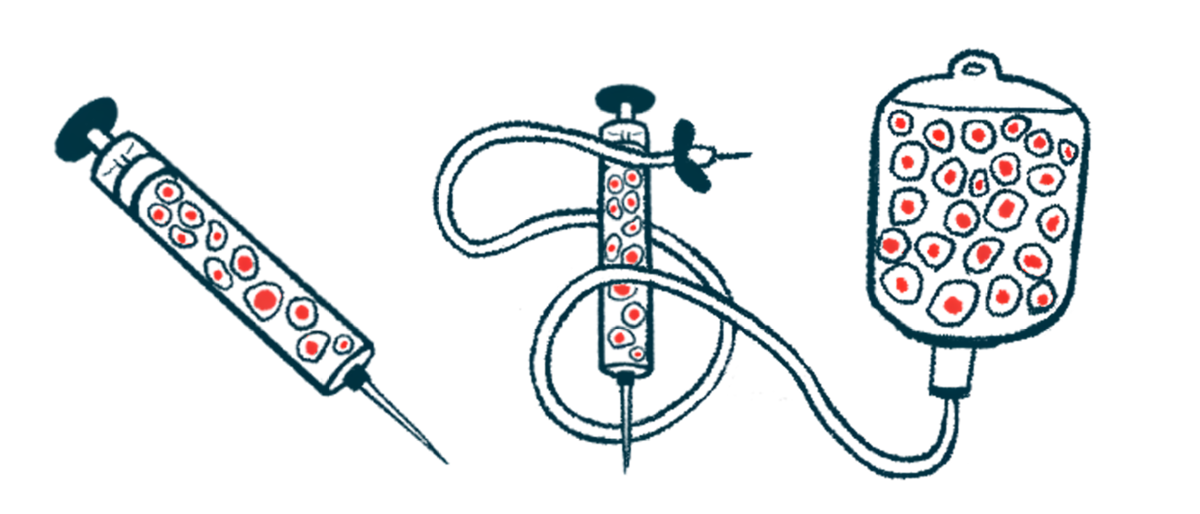 Illustration of syringes and an infusion bag filled with red cells to convey stem cell therapy.