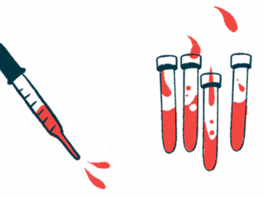 A squirting dropper is seen alongside four vials half-filled with blood.