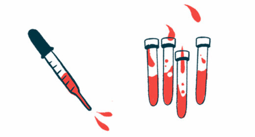 A squirting dropper is seen alongside four vials half-filled with blood.