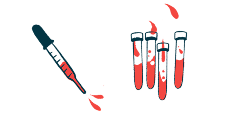 A squirting syringe is seen alongside four half-filled vials containing a red liquid.