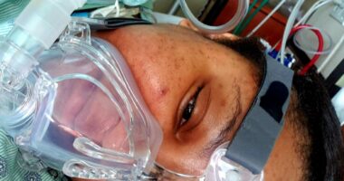 A woman lies in a hospital bed with an oxygen mask covering her nose and mouth.