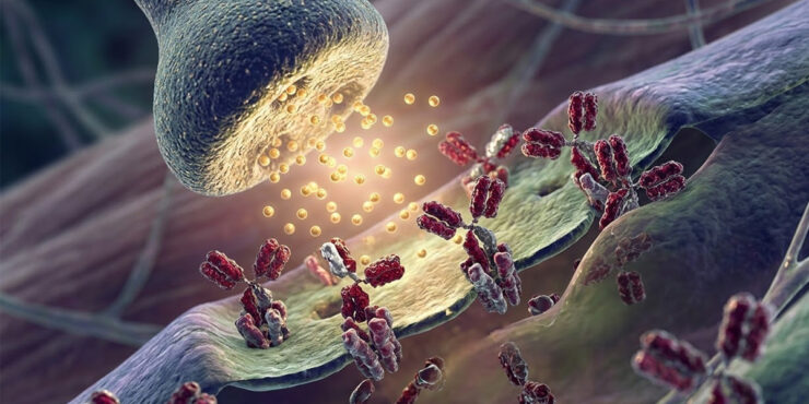 Myasthenia Gravis clinical overview