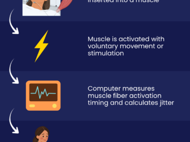 A graphic shows how single-fiber EMG works.