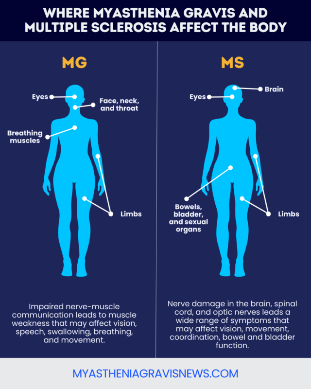 A graphic shows the differences in where myasthenia gravis and multiple sclerosis affect the body.